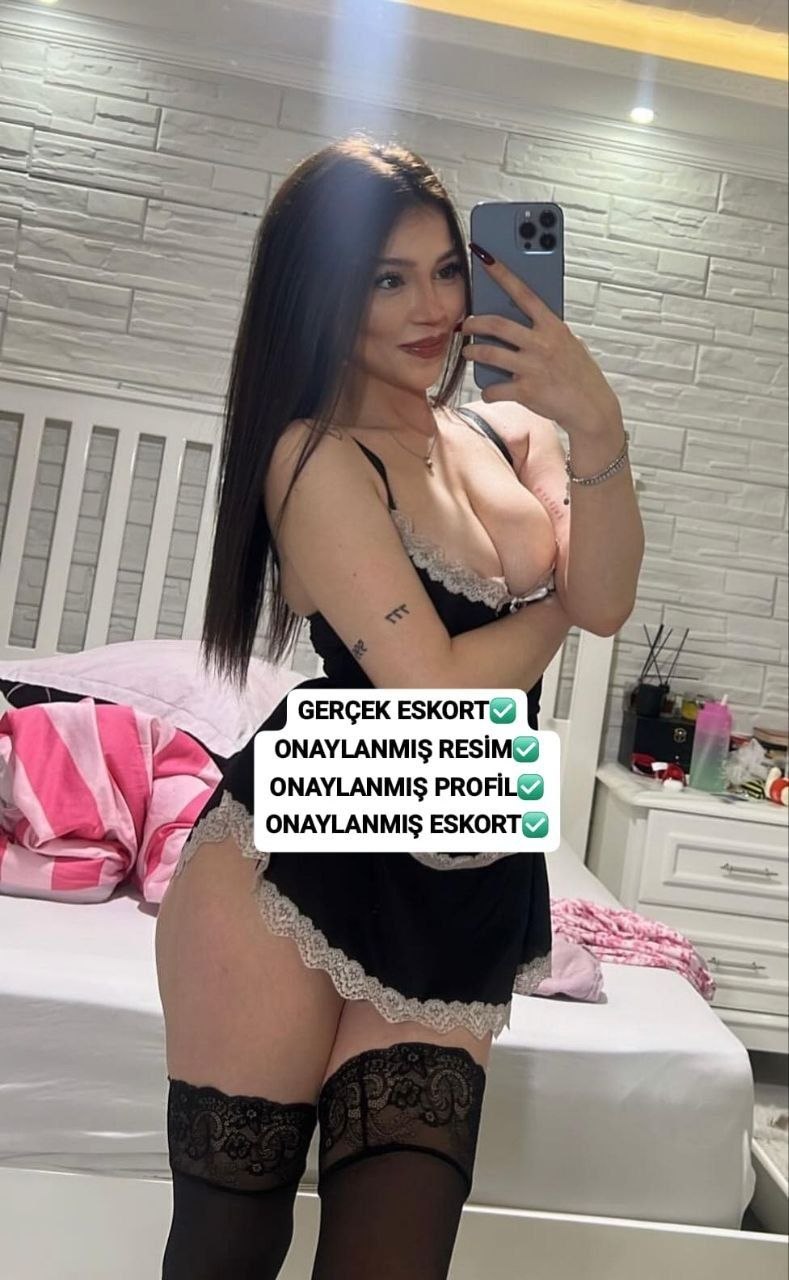 Bey Estetik Partner Escort Bayan Ala